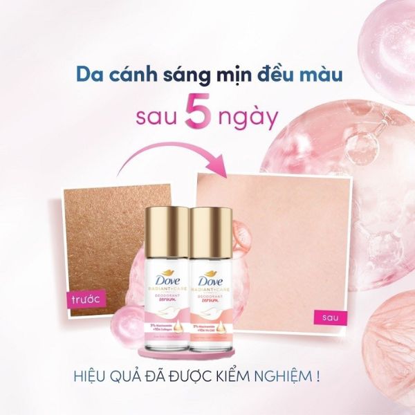Lăn Khử Mùi Dove 3% Niacinamide